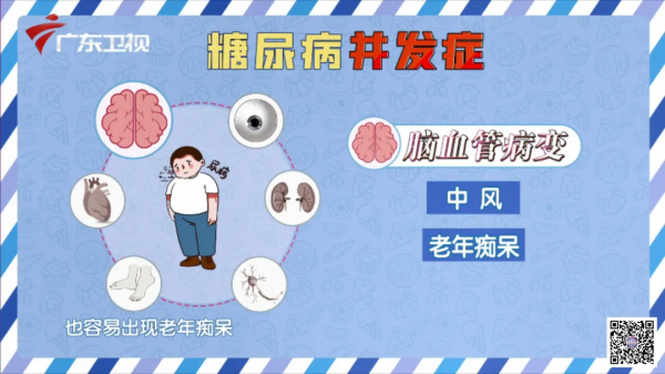 每一個想要管好血糖的人，請收藏好這份控糖妙方