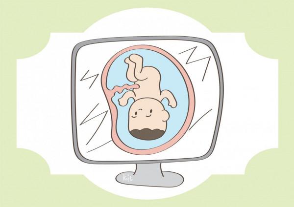 孕期去做B超,面板上被塗一層液體,這是什麼? 孕期去做B超,面板上被塗一層液體,這是什麼?