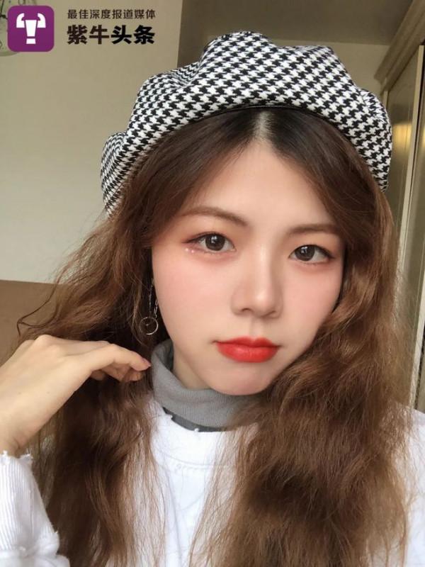 24歲女生抗癌一年：做3次化療30多次放療 脖子潰爛