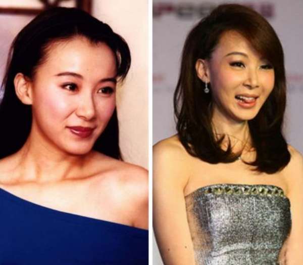 初見驚為天人,再見臉僵如石!這10位女星的臉,到底怎麼了 初見驚為天人,再見臉僵如石!這10位女星的臉,到底怎麼了