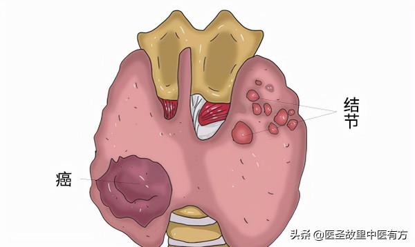 中藥止痛神方,兩味藥泡水,即可祛瘀、止痛、散結,讓你展顏開懷 中藥止痛神方,兩味藥泡水,即可祛瘀、止痛、散結,讓你展顏開懷
