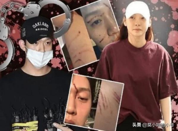 抑鬱症不是病嗎？因抑鬱選擇自殺的9位明星，最小的僅22歲