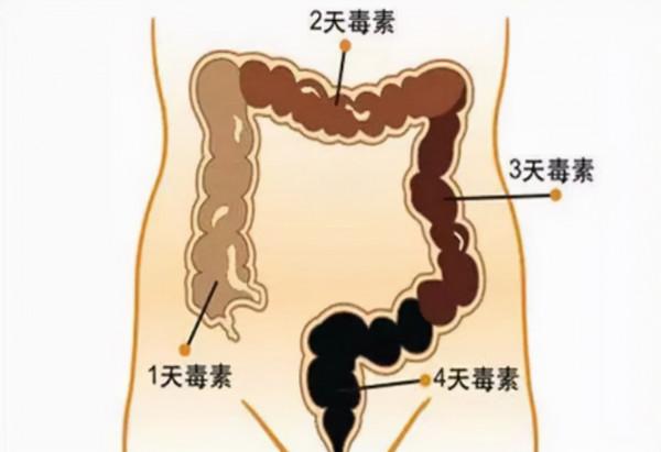 人體內真有6公斤宿便嗎？怎麼才能排出那些&OpenCurlyDoubleQuote;賴著不走&rdquo;的宿便？