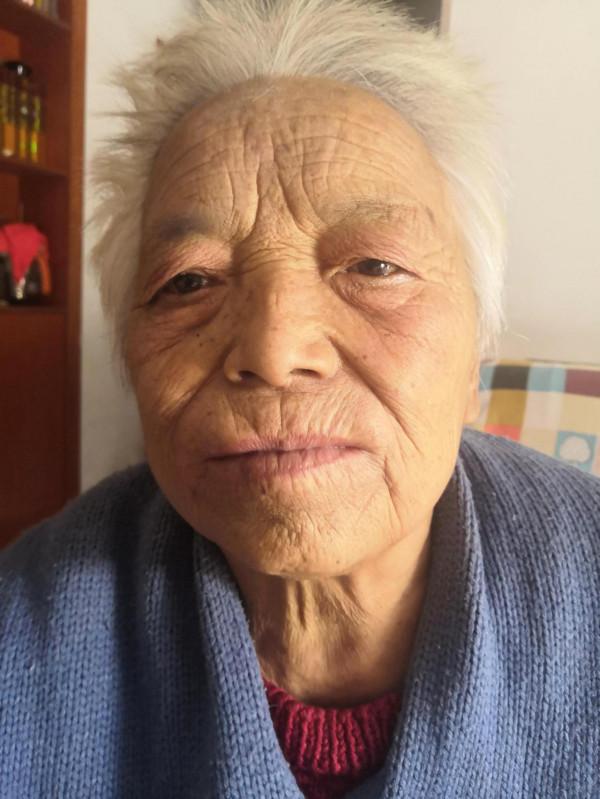 一把木梳,一個吹風機治面癱 一把木梳,一個吹風機治面癱