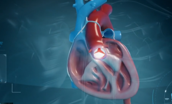 故事:32歲男子拉肚子兩週,突然心臟驟停,檢查結果讓醫生直冒冷汗