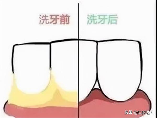 16個實用口腔小常識，一定有你想問的