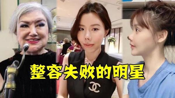 “娛樂圈”的整容臉 “娛樂圈”的整容臉