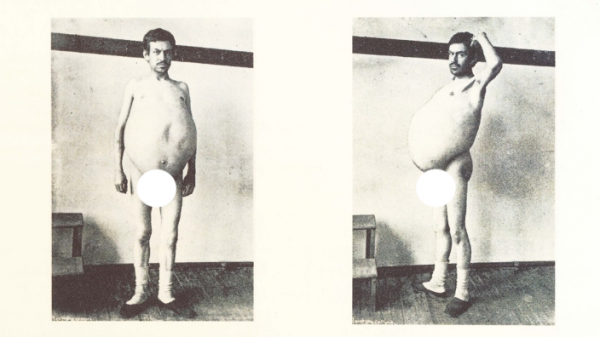 愛因斯坦的大腦、人類最大便便……看了這座博物館，我大開眼界