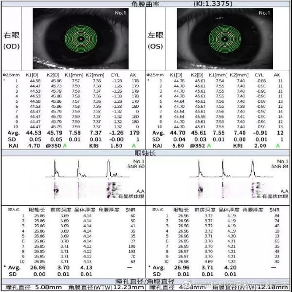 ICL晶體植入術前和術後要做哪些檢查？一次說明白