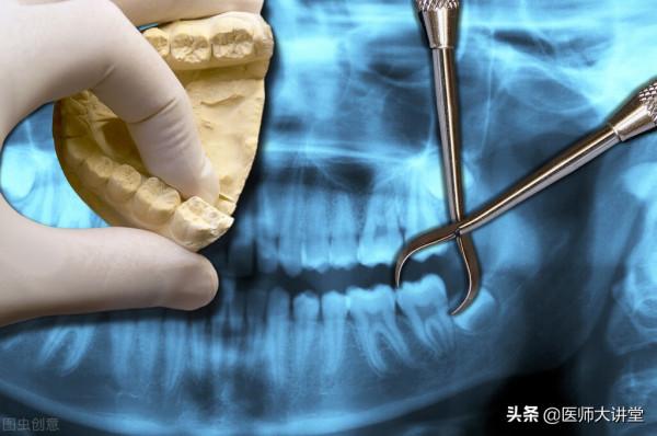 注意：拔牙後出現發熱，臨床病例分享