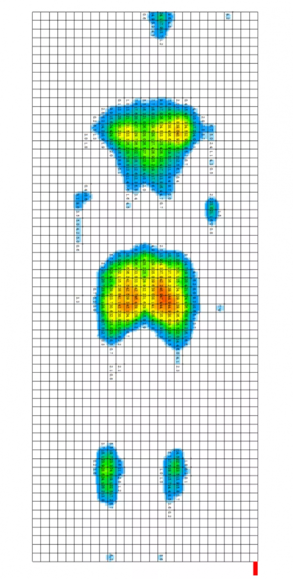 實驗案例丨SPI壓力分佈採集系統應用於醫療床的設計與研發