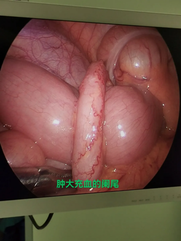 腹痛，如何識別孩子發出的求救&OpenCurlyDoubleQuote;訊號&rdquo;