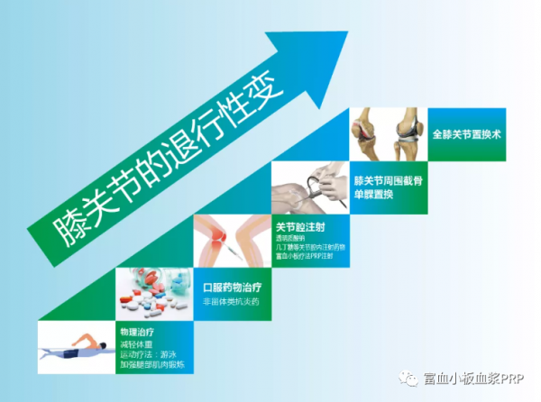 骨關節炎的臨床藥物治療