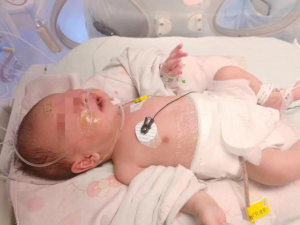 大手術，零出血！女嬰膽管擴張至碗口大，手術創七個&OpenCurlyDoubleQuote;世界第一&rdquo;