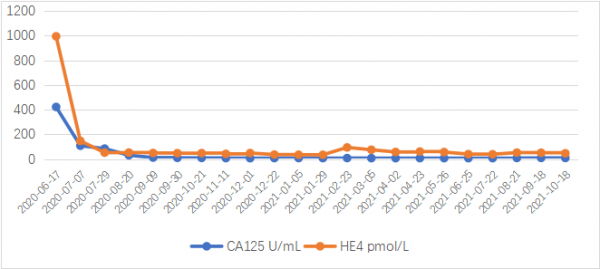 「卵巢醫聲」尼拉帕利單藥一線維持治療實現HRD陽性（罕見RAD51C胚系突變）晚期卵巢癌患者獲益