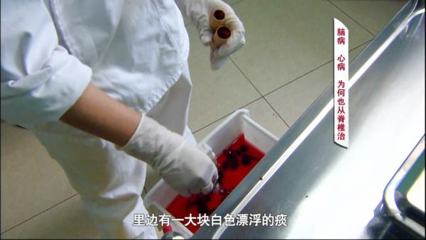 增生、囊腫、結節皆屬“無形之痰”，清代名醫名方加減，化痰軟堅