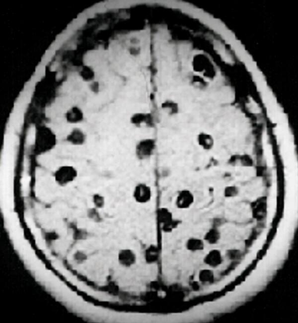 吞寄生蟲，用腐蝕液體洗臉，吃砒霜，英國女性超重口的變美套路