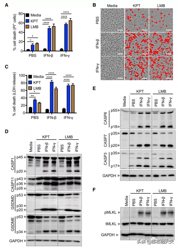 細胞死亡領域缺失的一塊拼圖:PANoptosis 細胞死亡領域缺失的一塊拼圖:PANoptosis