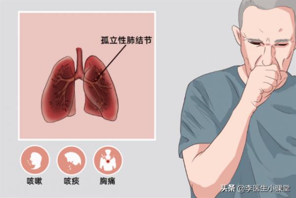 如何讓你的肺結節變小或者消失? 如何讓你的肺結節變小或者消失?