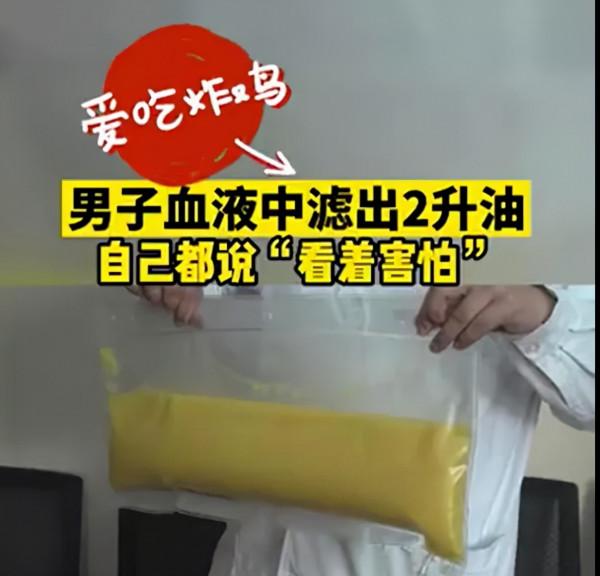 肥胖導致血管“流油”，可以透過透析去掉？這可不是常規減肥操作