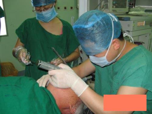 酒桌上的腦出血提醒大家：每一個高血壓的人，都是在拿命喝酒