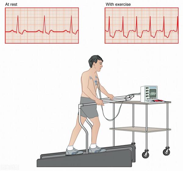 高血壓患者每天走多少步能重獲健康？步數不靠譜，這個方法很實用
