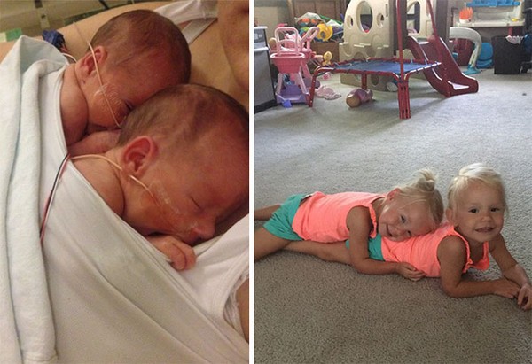 “手牽手”出生的雙胞胎姐妹花,長大了仍然每天黏在一起分不開 “手牽手”出生的雙胞胎姐妹花,長大了仍然每天黏在一起分不開