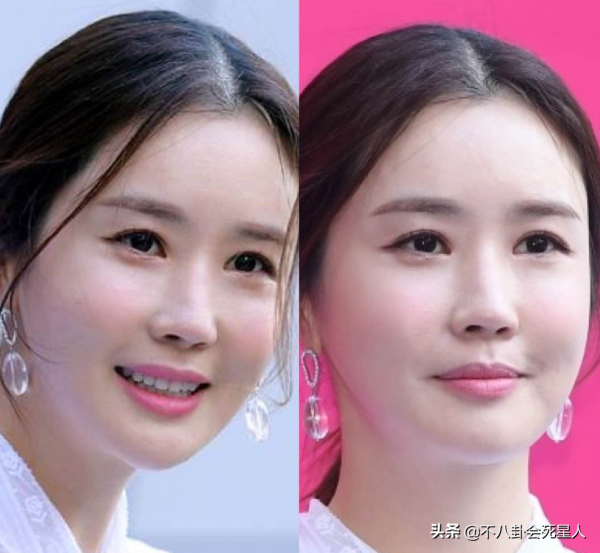 那些紅極一時的韓流明星,終於被整容後遺症給拖累了 那些紅極一時的韓流明星,終於被整容後遺症給拖累了