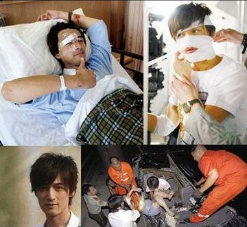 8位整容男明星，有的整成真人版馬里奧，有的為戲整容令人惋惜