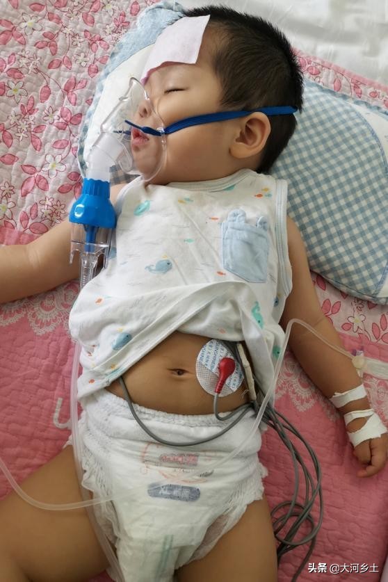 2歲女孩頻繁發燒,病因是體內缺一種細胞,目前已花百萬元治療費 2歲女孩頻繁發燒,病因是體內缺一種細胞,目前已花百萬元治療費