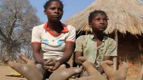 “龍蝦民族”只有兩個腳趾,科學家研究結果或許顛覆了進化理論 “龍蝦民族”只有兩個腳趾,科學家研究結果或許顛覆了進化理論