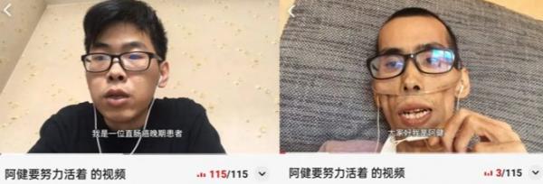 年輕小夥患直腸癌，才一年多就枯瘦如柴？離世前的忠告，引人深思