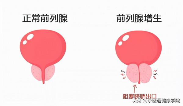 夜尿多不是小事！需警惕4種疾病