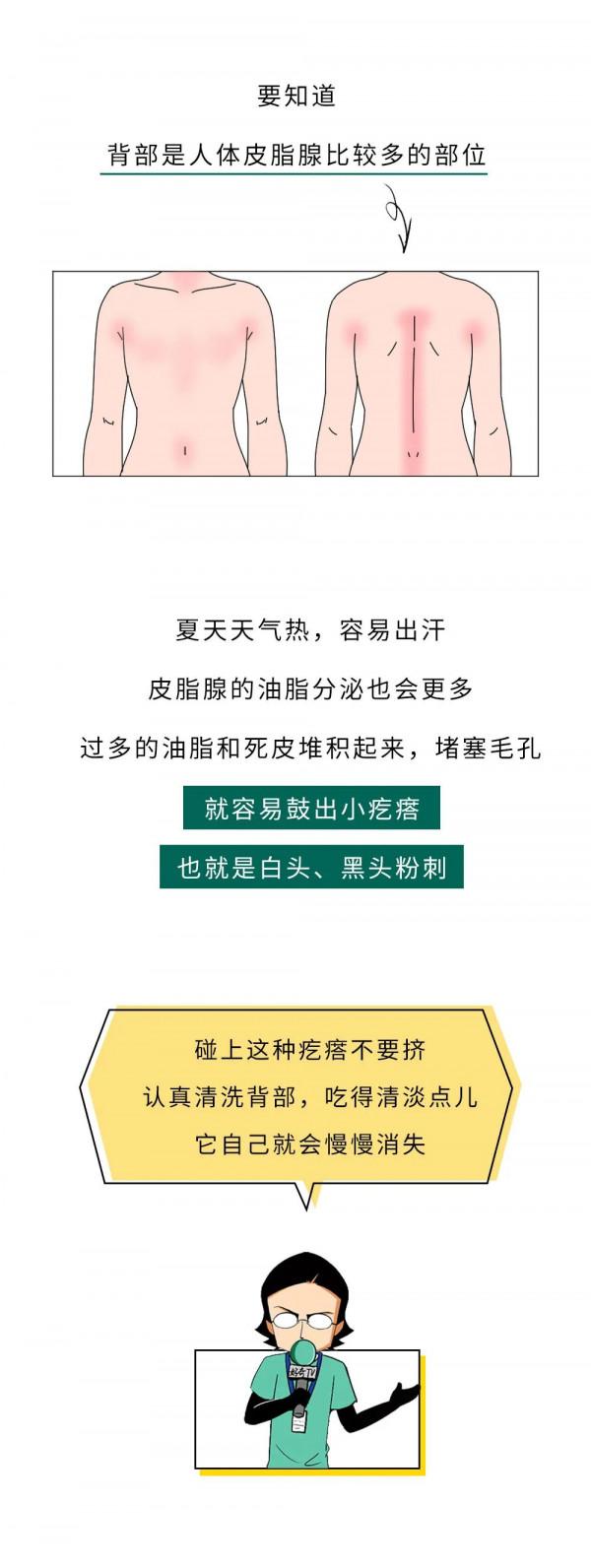 漫畫科普：“揹負”太多，“疹”的很累！