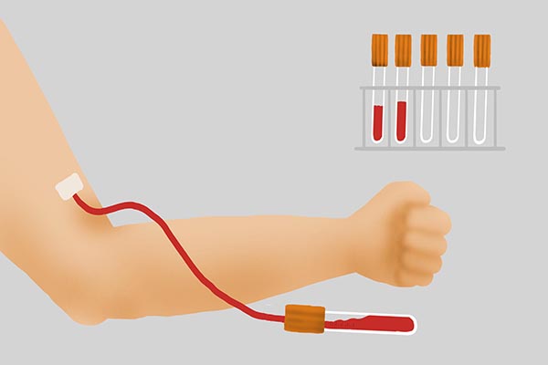 經常一次抽好幾管血，會不會貧血？抽血前後要注意什麼？
