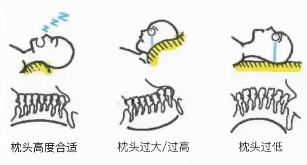 進來避雷！這些小習慣會讓你變醜