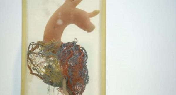 轟動！將人體切成8556個橫切面，廣東院士打造首例“數字人”，獲國家科技獎！