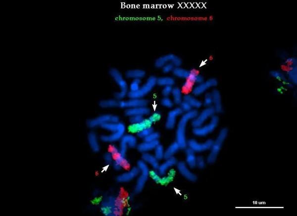 「技術分享」熒光原位雜交技術全攻略 「技術分享」熒光原位雜交技術全攻略