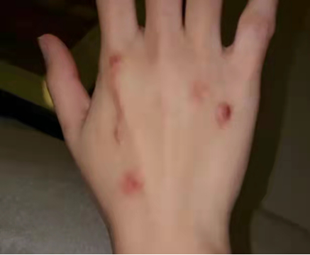 狂吃不胖？那些被催吐毀掉的中國女孩