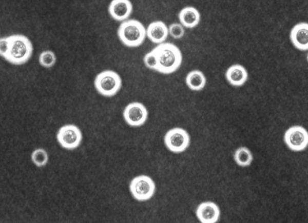 切爾諾貝利發現的真菌，靠“吞輻射”繁殖，有可能成為航天黑科技