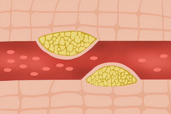 糖尿病,在夏日能放心吃西紅柿嗎?實驗告訴你西紅柿的升糖指數 糖尿病,在夏日能放心吃西紅柿嗎?實驗告訴你西紅柿的升糖指數