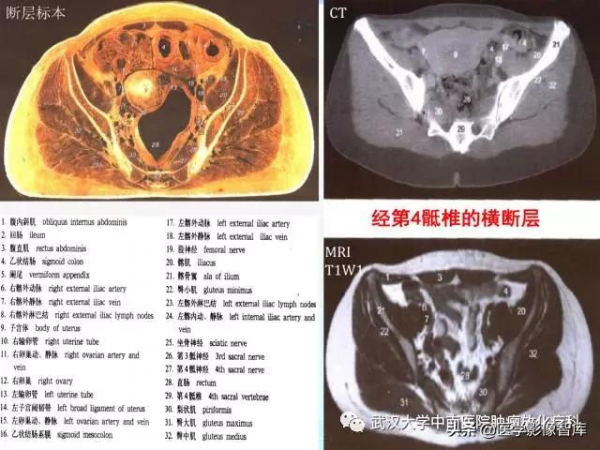 CT斷層解剖圖譜最全總結「推薦收藏」 CT斷層解剖圖譜最全總結「推薦收藏」