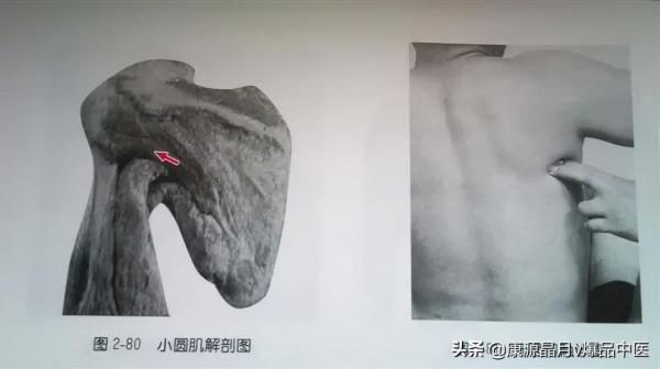 肩部疼痛的觸診圖解（很珍貴資料），值得一看