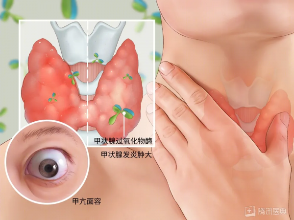 體重一月狂掉30斤，開心過後，我慌了… …