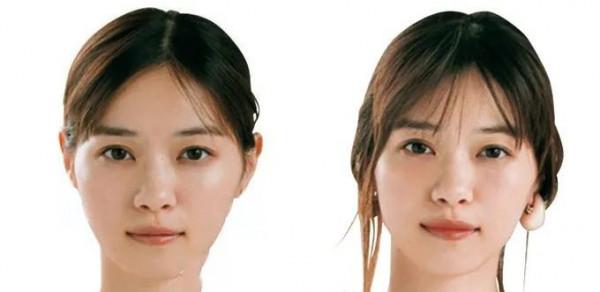 下巴後縮還嘴凸?記住這2招,拒絕變美絆腳石 下巴後縮還嘴凸?記住這2招,拒絕變美絆腳石