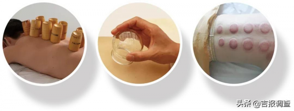 中醫專家出妙招：女性冬季養生，首選這些中醫傳統療法