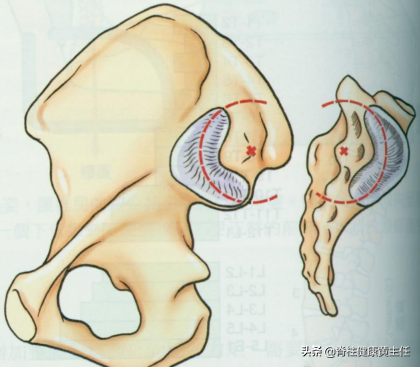 別把這種腰痛錯當成腰椎間盤突出了,是骶髂關節發生了紊亂 別把這種腰痛錯當成腰椎間盤突出了,是骶髂關節發生了紊亂