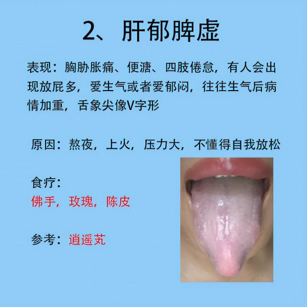 女人常見6種症狀，以及對應舌象和解決的方法分享