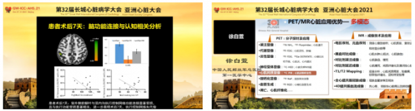 GW-ICC 報道|核醫學論壇:多模態影像技術在心血管領域的新進展 GW-ICC 報道|核醫學論壇:多模態影像技術在心血管領域的新進展