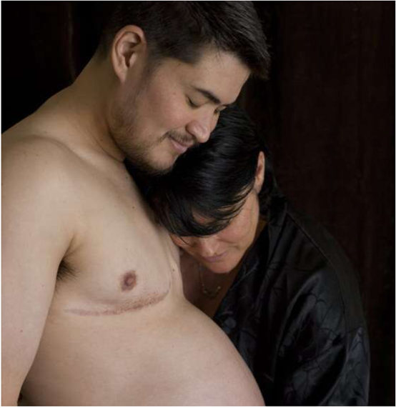 托馬斯·比蒂：世界上第一個懷孕的男子